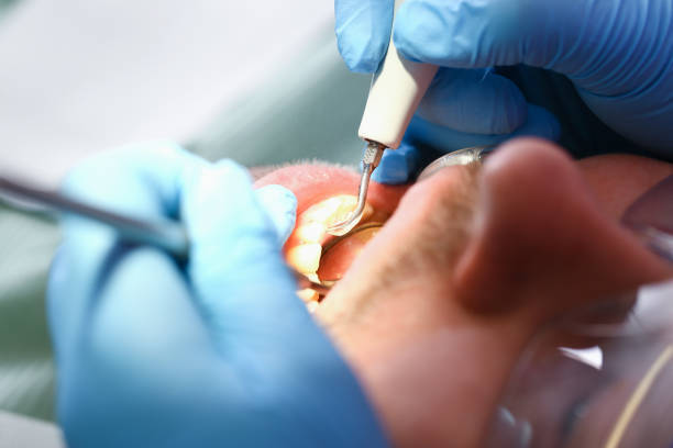 Best Broken Tooth Emergency  in Sandy Oaks, TX